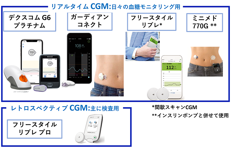 日本で使用可能なCGMデバイス一覧