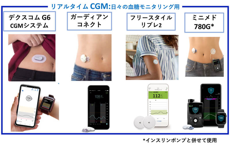 日本で使用可能なCGMデバイス一覧