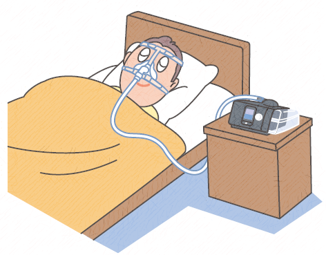 CPAP治療中のイラスト